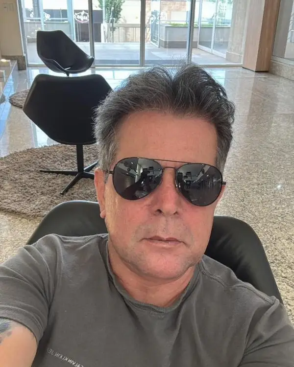 Paciente depois do transplante capilar